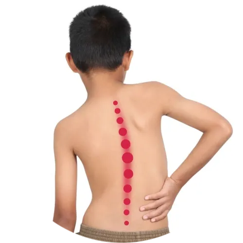 Лечение сколиоза  и нарушений осанки  у детей