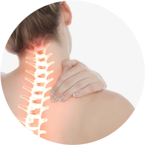 Защемление седалищного нерва (ишиас, люмбоишиалгия)